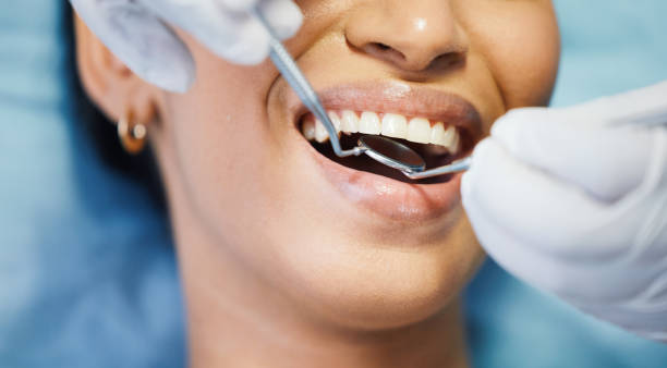 Best Lost Filling or Crown Replacement in Chackbay, LA
