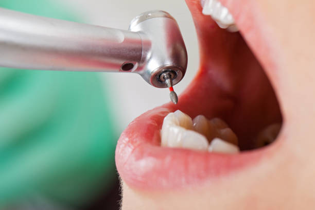 Best Emergency Cosmetic Dentistry (e.g., broken veneers) in Chackbay, LA